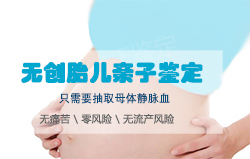 苏州需要怎么办理孕期亲子鉴定