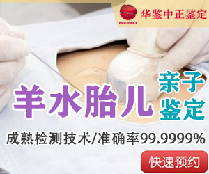 苏州羊水胎儿亲子鉴定