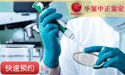 苏州同一父系亲缘鉴定